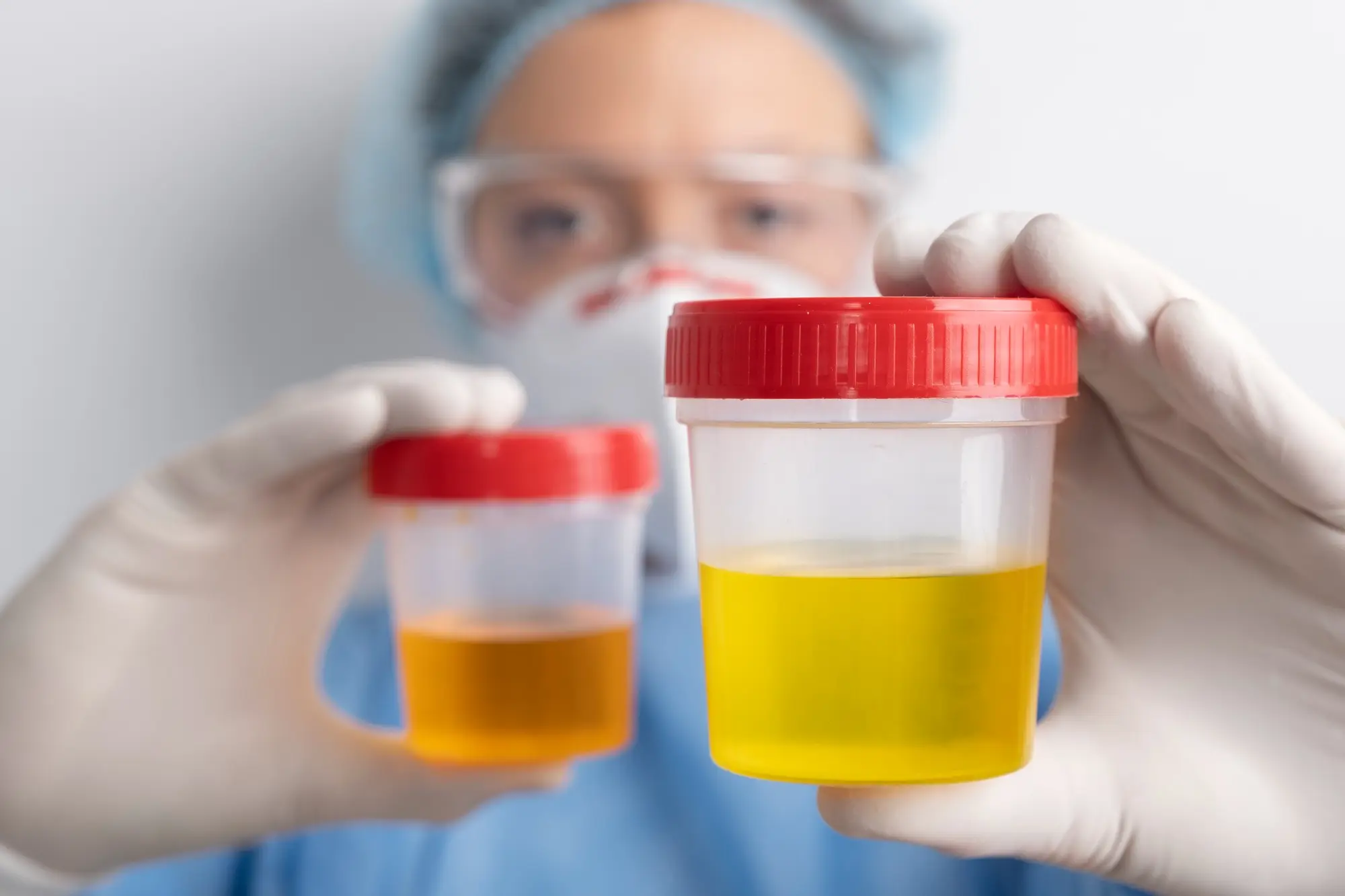 Urinary Tract Infection UTI Testing